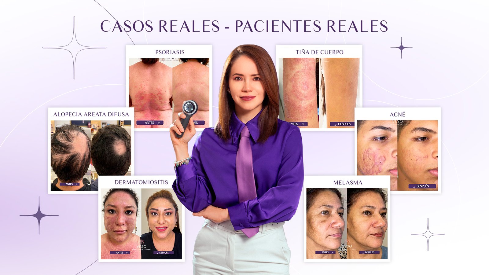 Casos reales - Pacientes reales